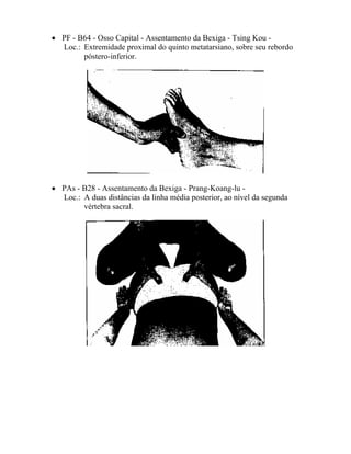 • PF - B64 - Osso Capital - Assentamento da Bexiga - Tsing Kou -
Loc.: Extremidade proximal do quinto metatarsiano, sobre seu rebordo
póstero-inferior.
• PAs - B28 - Assentamento da Bexiga - Prang-Koang-lu -
Loc.: A duas distâncias da linha média posterior, ao nível da segunda
vértebra sacral.
 
