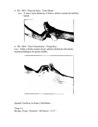 • PG - B63 - Porta de Ouro - Tsinn-Menn -
Loc.: A uma e meia distâncias à frente e abaixo à ponta do maléolo
lateral.
• PH - B64 - Vale Comunicante - Trong-Kou -
Loc.: Sobre o bordo externo do pé, adiante (distal) da articulação
metatarsofalângica do quinto artelho.
Quando Tonificar ou Sedar o Meridiano
Yang (+)
Bexiga: (Yang - Posterior - De baixo) - 15-17 -
 