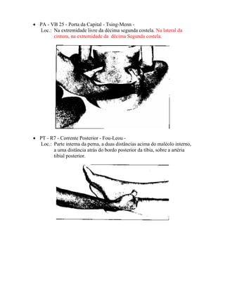 • PA - VB 25 - Porta da Capital - Tsing-Menn -
Loc.: Na extremidade livre da décima segunda costela. Na lateral da
cintura, na extremidade da décima Segunda costela.
• PT - R7 - Corrente Posterior - Fou-Leou -
Loc.: Parte interna da perna, a duas distâncias acima do maléolo interno,
a uma distância atrás do bordo posterior da tíbia, sobre a artéria
tibial posterior.
 