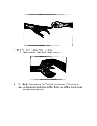 • PF e PS - CS7 - Grande Platô - Ta-Ling -
Loc.: Na metade da dobra de flexão da munheca.
• PAs - B14 - Assentamento da Circulação-sexualidade - Tsiue-Inn-Iu
Loc.: A duas distâncias da linha média, debaixo da apófise espinhosa da
quarta vértebra torácica.
 
