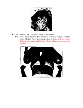 • - PA - (Geral) - VC5 - Porta da Pedra - Che-Menn –
Loc.: Linha média anterior, duas distâncias abaixo do umbigo. Também
conhecido por: Hara - centro energético do corpo. A 2 cun abaixo
da borda da cicatriz umbilical ou a 3 cun sobre a margem superior
do púbis.
 