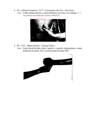 • PA - (Gênito-Urinário) - VC7 - Cruzamento dos Yin - Inn-Tsiao –
Loc.: Linha média anterior, a meia distância, por baixo, do umbigo. A 1
cun abaixo da borda da cicatriz umbilical.
• PT - TA3 - Ilhota Central - Tchong-Tchou -
Loc.: Lado dorsal da mão, entre o quarto e o quinto metacarpiano, a uma
distância do ponto TA2, na horizontal do ponto ID3.
 