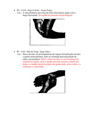 • PS - TA10 - Poço Celeste - Tienn-Tsing -
Loc.: A uma distância, por cima da fossa olecraniana; pegar com o
braço flexionado. No tendão do músculo tríceps braquial.
• PF - TA4 - Mar de Yang - Iang-Tchre -
Loc.: Dorso da mão, no prolongamento do espaço formado pelo terceiro
e quarto metacarpianos, num oco formado pela articulação do
rádio e da munheca. Sobre o dorso da mão, ao nível da prega de
extensão do punho, entre o tendão músculo extensor comum dos
dedos e o tendão músculo próprio do quinto dedo, entre a ulna, e o
semilunar e o piramidal.
 