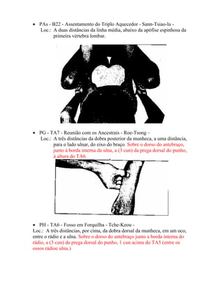 • PAs - B22 - Assentamento do Triplo Aquecedor - Sann-Tsiao-lu -
Loc.: A duas distâncias da linha média, abaixo da apófise espinhosa da
primeira vértebra lombar.
• PG - TA7 - Reunião com os Ancestrais - Roe-Tsong –
Loc.: A três distâncias da dobra posterior da munheca, a uma distância,
para o lado ulnar, do eixo do braço. Sobre o dorso do antebraço,
junto à borda interna da ulna, a (3 cun) da prega dorsal do punho,
à altura do TA6.
• PH - TA6 - Fosso em Forquilha - Tche-Keou -
Loc.: A três distâncias, por cima, da dobra dorsal da munheca, em um oco,
entre o rádio e a ulna. Sobre o dorso do antebraço junto a borda interna do
rádio, a (3 cun) da prega dorsal do punho, 1 cun acima do TA5 (entre os
ossos rádioe ulna.)
 