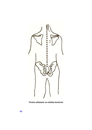 Pontos utilizados na cefaléia tensional



48
 