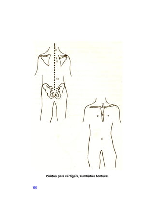 Pontos para vertigem, zumbido e tonturas


50
 