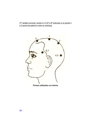 (7ª vértebra cervical), pontos 2 e 3 (5ª e 6ª torácicas) e os pontos 4
e 5 (acima do esterno e entre os mamilos).




                  Pontos utilizados na insônia




54
 