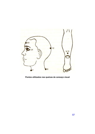 Pontos utilizados nas queixas de cansaço visual




                                                  57
 