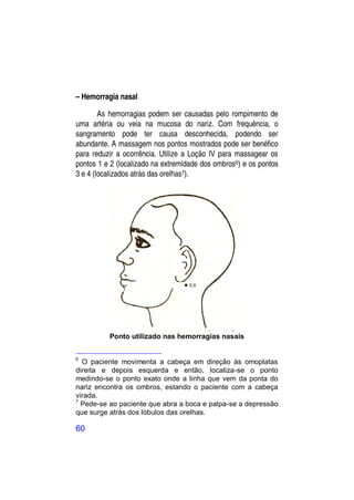 – Hemorragia nasal

        As hemorragias podem ser causadas pelo rompimento de
uma artéria ou veia na mucosa do nariz. Com frequência, o
sangramento pode ter causa desconhecida, podendo ser
abundante. A massagem nos pontos mostrados pode ser benéfico
para reduzir a ocorrência. Utilize a Loção IV para massagear os
pontos 1 e 2 (localizado na extremidade dos ombros 6) e os pontos
3 e 4 (localizados atrás das orelhas7).




          Ponto utilizado nas hemorragias nasais


6
  O paciente movimenta a cabeça em direção às omoplatas
direita e depois esquerda e então, localiza-se o ponto
medindo-se o ponto exato onde a linha que vem da ponta do
nariz encontra os ombros, estando o paciente com a cabeça
virada.
7
  Pede-se ao paciente que abra a boca e palpa-se a depressão
que surge atrás dos lóbulos das orelhas.

60
 