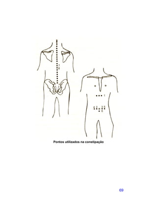 Pontos utilizados na constipação




                                   69
 