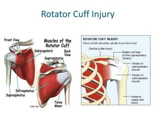                Rotator Cuff Injury