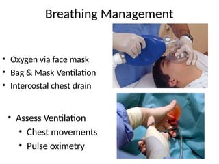 Breathing Management
• Oxygen via face mask
• Bag & Mask Ventilation
• Intercostal chest drain
• Assess Ventilation
• Chest movements
• Pulse oximetry
 