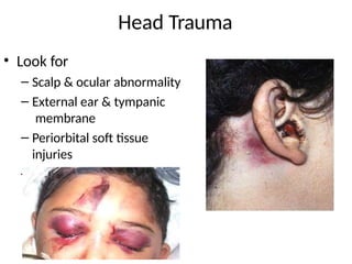 Head Trauma
• Look for
– Scalp & ocular abnormality
– External ear & tympanic
membrane
– Periorbital soft tissue
injuries
– Fractures
 
