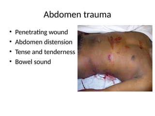 Abdomen trauma
• Penetrating wound
• Abdomen distension
• Tense and tenderness
• Bowel sound
 