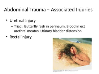 Abdominal Trauma – Associated Injuries
• Urethral Injury
– Triad : Butterfly rash in perineum, Blood in ext
urethral meatus, Urinary bladder distension
• Rectal injury
 