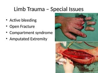 Limb Trauma – Special Issues
• Active bleeding
• Open Fracture
• Compartment syndrome
• Amputated Extremity
 