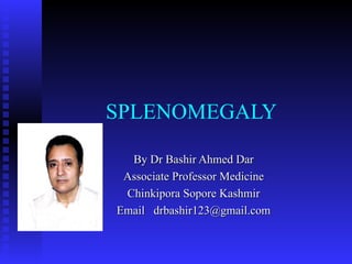 SPLENOMEGALY  By Dr Bashir Ahmed Dar Associate Professor Medicine Chinkipora Sopore Kashmir Email  [email_address] 