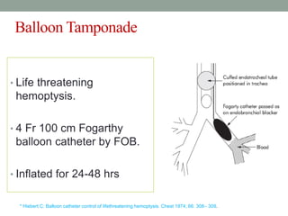Balloon Tamponade
• Life threatening
hemoptysis.
• 4 Fr 100 cm Fogarthy
balloon catheter by FOB.
• Inflated for 24-48 hrs
* Hiebert C: Balloon catheter control of lifethreatening hemoptysis. Chest 1974; 66: 308– 309.
 