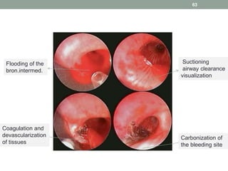 63
Flooding of the
bron.intermed.
Suctioning
airway clearance
visualization
Coagulation and
devascularization
of tissues
Carbonization of
the bleeding site
 