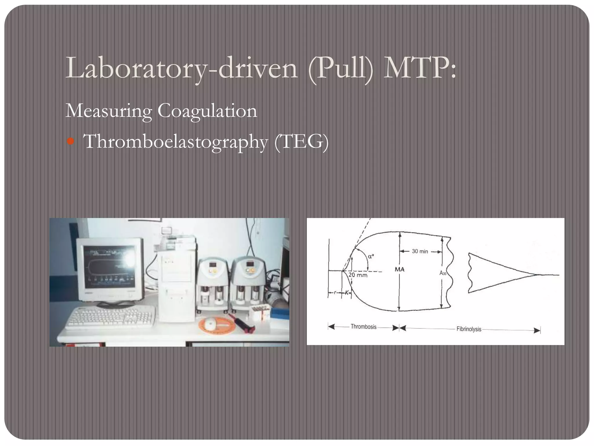 Laboratory-driven (Pull) MTP:
Measuring Coagulation
 Thromboelastography (TEG)
 