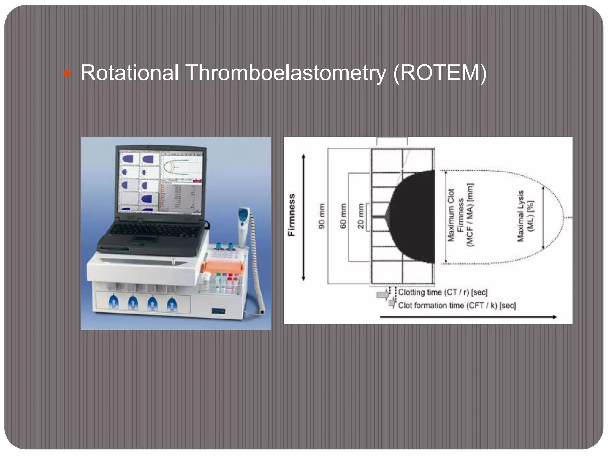  Rotational Thromboelastometry (ROTEM)
 