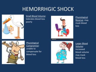 HEMORRHGIC SHOCK
Small Blood Volume:
tolerates blood loss
poorly
Physiological
Compromise:
unable to
compensate for
blood loss
Physiological
Reserve: may
mask blood
loss
Larger Blood
Volume:
increased
blood volume
may mask
blood loss
 