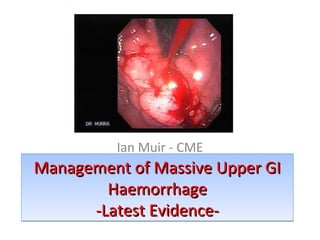 Ian Muir - CME

Management of Massive Upper GI
Haemorrhage
-Latest Evidence-

 