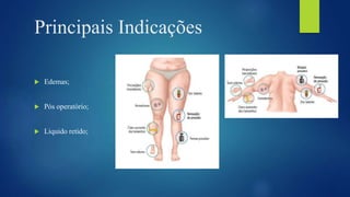 Principais Indicações
 Edemas;
 Pós operatório;
 Liquido retido;
 
