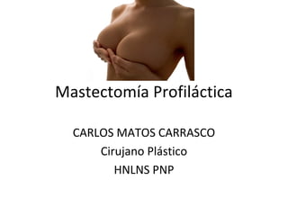 Mastectomía Profiláctica
CARLOS MATOS CARRASCO
Cirujano Plástico
HNLNS PNP
 