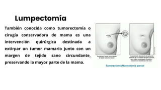 mastectom-a-y-lumpectom-a-presentaci-n-cirug-a-pdf