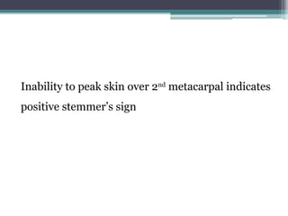 Stemmer Sign Test Positive Example Mastectomy physiotherapy management notes.pptx