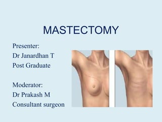 MASTECTOMY
Presenter:
Dr Janardhan T
Post Graduate

Moderator:
Dr Prakash M
Consultant surgeon
 