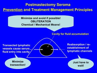 Postmastectomy Seroma
Prevention and Treatment Management Principles
Reabsorption / re-
establishment of
lymphatic channels
Cavity for fluid accumulation
Transected lymphatic
vessels cause serum
fluid entry into cavity
Minimize
transection!
Just have to
wait!
Minimize and avoid if possible!
OBLITERATION
Chemical / Mechanical Means!
 