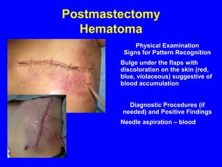 Postmastectomy
Hematoma
Physical Examination
Signs for Pattern Recognition
Bulge under the flaps with
discoloration on the skin (red,
blue, violaceous) suggestive of
blood accumulation
Diagnostic Procedures (if
needed) and Positive Findings
Needle aspiration – blood
 