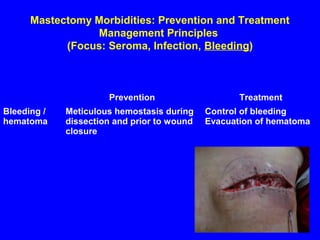 Mastectomy Morbidities: Prevention and Treatment
Management Principles
(Focus: Seroma, Infection, Bleeding)
Prevention Treatment
Bleeding /
hematoma
Meticulous hemostasis during
dissection and prior to wound
closure
Control of bleeding
Evacuation of hematoma
 