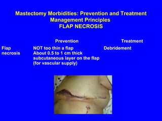 Mastectomy Morbidities: Prevention and Treatment
Management Principles
FLAP NECROSIS
Prevention Treatment
Flap
necrosis
NOT too thin a flap
About 0.5 to 1 cm thick
subcutaneous layer on the flap
(for vascular supply)
Debridement
 