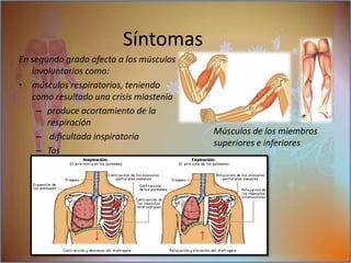 los músculos masticatorios