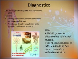 Investigación Aunque la miastenia gravis puede afectar cualquier músculo voluntario los músculos que el ojo de control y movimiento de los párpados la expresión facial y la deglución son los más frecuentemente afectados El inicio del trastorno puede ser repentino. Los síntomas a menudo no se reconocen inmediatamente como miastenia gravis. 