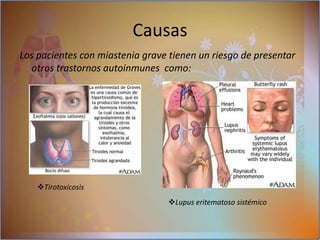 permiten controlar los receptores de la unión de neuromuscular bloqueando y distribuyendo los receptores teniendo una dificultad de transmisión de señales Originando una baja estimulación del musculo Explicando la debilidad muscular de esta enfermedad Causas 