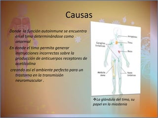 Lupus eritematoso sistémicoCausasArtritis reumatoideDonde  la función autoinmune se encuentra en el timo determinándose como anormal En donde el timo permita generar instrucciones incorrectas sobre la producción de anticuerpos receptores de acetilcolina creando así el ambiente perfecto para un trastorno en la transmisión neuromuscular .Causas La glándula del timo, su papel en la miasteniaSíntomasinicio es repentino reconoce inmediatamente primer grado afecta los músculos voluntarios específicamente afecta los músculos de la cara:movimientos ocular