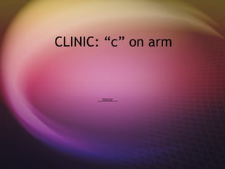 CLINIC: “c” on arm 