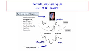 Peptides natriurétiques
BNP et NT-proBNP
Synthèse modulée par :
 