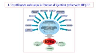 L’insuffisance cardiaque à fraction d’éjection préservée: HFpEF
 