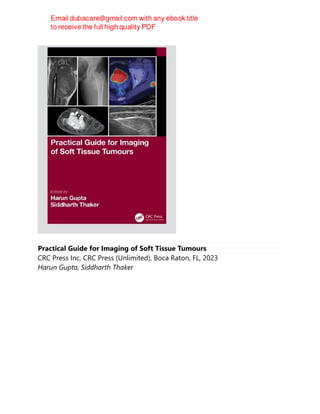 Practical Guide for Imaging of Soft Tissue Tumours
CRC Press Inc, CRC Press (Unlimited), Boca Raton, FL, 2023
Harun Gupta, Siddharth Thaker
 
