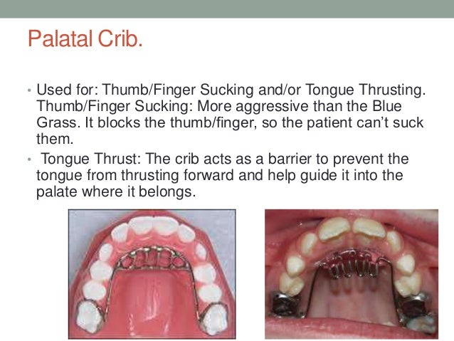 Mastering Orthodontic Appliances