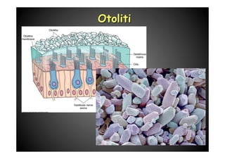 Otoliti
 