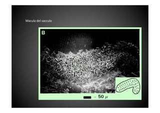 Macula	
 del	
 sacculo	
 
 