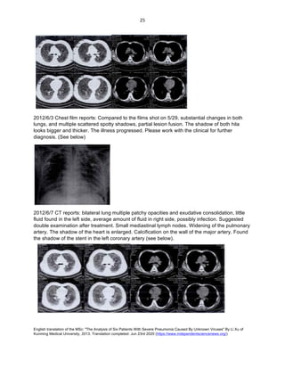 English translation of the MSc: "The Analysis of Six Patients With Severe Pneumonia Caused By Unknown Viruses" By Li Xu of
Kunming Medical University, 2013. Translation completed: Jun 23rd 2020 (https://www.independentsciencenews.org/)
	
	
25	
2012/6/3 Chest film reports: Compared to the films shot on 5/29, substantial changes in both
lungs, and multiple scattered spotty shadows, partial lesion fusion. The shadow of both hila
looks bigger and thicker. The illness progressed. Please work with the clinical for further
diagnosis. (See below)
2012/6/7 CT reports: bilateral lung multiple patchy opacities and exudative consolidation, little
fluid found in the left side, average amount of fluid in right side, possibly infection. Suggested
double examination after treatment. Small mediastinal lymph nodes. Widening of the pulmonary
artery. The shadow of the heart is enlarged. Calcification on the wall of the major artery. Found
the shadow of the stent in the left coronary artery (see below).
 