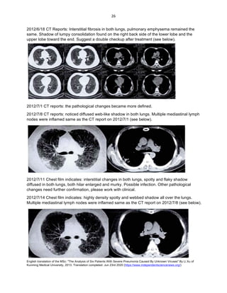 English translation of the MSc: "The Analysis of Six Patients With Severe Pneumonia Caused By Unknown Viruses" By Li Xu of
Kunming Medical University, 2013. Translation completed: Jun 23rd 2020 (https://www.independentsciencenews.org/)
	
	
26	
2012/6/18 CT Reports: Interstitial fibrosis in both lungs, pulmonary emphysema remained the
same. Shadow of lumpy consolidation found on the right back side of the lower lobe and the
upper lobe toward the end. Suggest a double checkup after treatment (see below).
2012/7/1 CT reports: the pathological changes became more defined.
2012/7/8 CT reports: noticed diffused web-like shadow in both lungs. Multiple mediastinal lymph
nodes were inflamed same as the CT report on 2012/7/1 (see below).
2012/7/11 Chest film indicates: interstitial changes in both lungs, spotty and flaky shadow
diffused in both lungs, both hilar enlarged and murky. Possible infection. Other pathological
changes need further confirmation, please work with clinical.
2012/7/14 Chest film indicates: highly density spotty and webbed shadow all over the lungs.
Multiple mediastinal lymph nodes were inflamed same as the CT report on 2012/7/8 (see below).
 