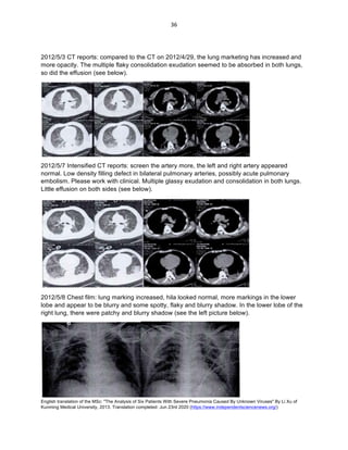 English translation of the MSc: "The Analysis of Six Patients With Severe Pneumonia Caused By Unknown Viruses" By Li Xu of
Kunming Medical University, 2013. Translation completed: Jun 23rd 2020 (https://www.independentsciencenews.org/)
	
	
36	
2012/5/3 CT reports: compared to the CT on 2012/4/29, the lung marketing has increased and
more opacity. The multiple flaky consolidation exudation seemed to be absorbed in both lungs,
so did the effusion (see below).
2012/5/7 Intensified CT reports: screen the artery more, the left and right artery appeared
normal. Low density filling defect in bilateral pulmonary arteries, possibly acute pulmonary
embolism. Please work with clinical. Multiple glassy exudation and consolidation in both lungs.
Little effusion on both sides (see below).
2012/5/8 Chest film: lung marking increased, hila looked normal, more markings in the lower
lobe and appear to be blurry and some spotty, flaky and blurry shadow. In the lower lobe of the
right lung, there were patchy and blurry shadow (see the left picture below).
 